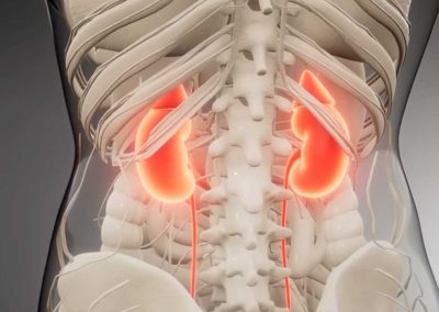 Understanding The Kidney-Blood Pressure Connection (Video)