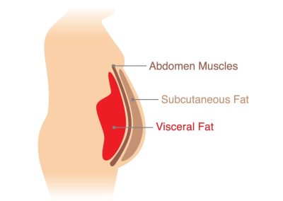 Why You Should Pay More Attention to Fat You Can’t See