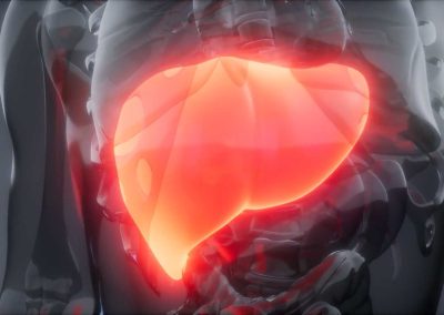 Silent Liver Disease (Video)