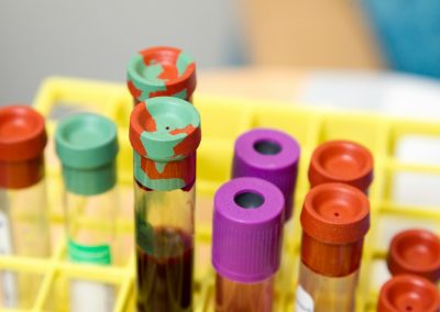 About Prostate Cancer