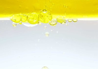 Oil, Water, Cholesterol, and Cardiovascular Disease (Video)